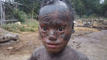 'നെഞ്ച് പൊട്ടും അവനെ കാണുമ്പോള്'; നിര്ധനനായ ഒരു പിതാവ് പറയുന്നു...