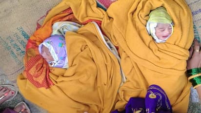 ஒட்டிப்பிறந்த இரட்டை குழந்தைகள்... கொரோனா- கோவிட் என பெயர் சூட்டிய பெற்றோர்..!