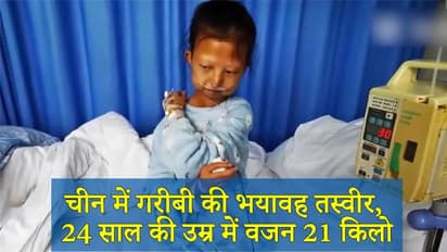 गरीबी ने ले ली लड़की की जान, पैसों की तंगी में हो गई थी सूख कर कांटा