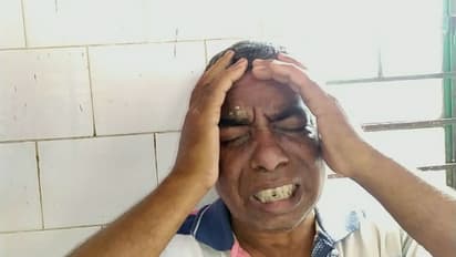 মারমুখী স্বামী, চোখে গরম খুন্তির ছ্যাঁকা স্ত্রীর