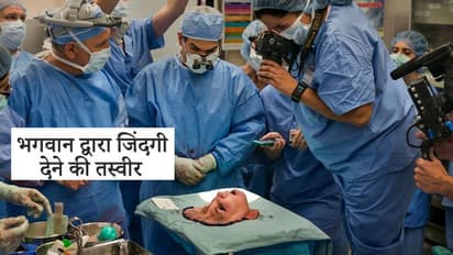 डॉक्टर्स ने प्लेट पर सजाया मुर्दे का चेहरा, मौत के बाद दूसरी जिंदगी रोशन कर गई लड़की