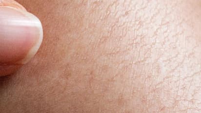 আর কেমিক্যাল নয়, লোমহীন ত্বক পেতে বাড়িতেই সহজে করে নিন ওয়াক্স