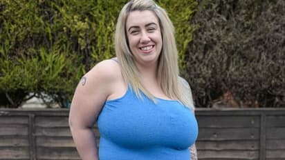 സ്തനങ്ങളുടെ അസാമാന്യ വലിപ്പം മൂലം വേദന; ഒടുവില്‍ ശസ്ത്രക്രിയയ്ക്കായി പിരിവ് ചോദിച്ച് യുവതി