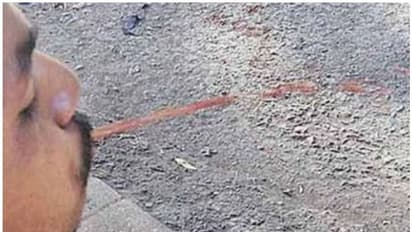 പൊതുസ്ഥലത്ത് തുപ്പിയാല് പോക്കറ്റ് കാലിയാകും; കര്ശന നടപടിയുമായി നഗരസഭ