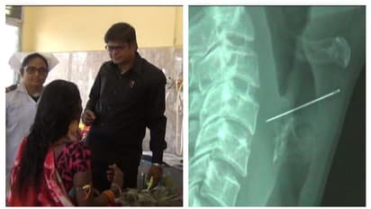 খাদ্যনালীতে বিঁধে সুচ, জটিল অস্ত্রোপচারে প্রাণ বাঁচালেন বাঁকুড়ার চিকিৎসকরা