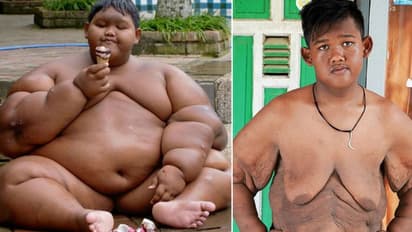 ആര്യ ഇനി ലോകത്തെ ഏറ്റവും വണ്ണമുള്ള കുട്ടിയല്ല; ഇത് അമ്പരപ്പിക്കുന്ന മാറ്റം...