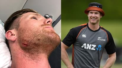 'സ്വന്തം മുഖത്തേക്ക് റിവേഴ്സ് സ്വീപ്പ് ചെയ്യല്ലേ'; താടി മുറിഞ്ഞിട്ടും രസകരമായ ട്വീറ്റുമായി ന്യൂസിലന്ഡ് താരം