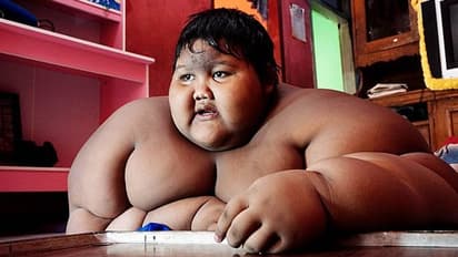 107 ಕೆಜಿ ತೂಕ ಇಳಿಸಿಕೊಂಡ ಬಾಲಕನ ಫಿಟ್ನೆಸ್ ಜರ್ನಿ !