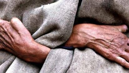 ഇന്ന് കുഷ്ഠരോഗ നിർമാർജ്ജന ദിനം; അറിയാം രോഗലക്ഷണങ്ങൾ, പ്രതിരോധം...