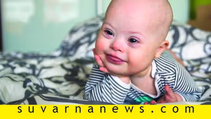 ಡೌನ್‌ ಸಿಂಡ್ರೋಮ್‌ ಮಗು ತೋರಿಸೋ ಪ್ರೀತಿ ಮುಂದೆ ಬೇರೇನೂ ಇಲ್ಲ!