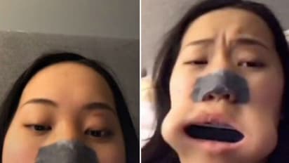 വായയ്ക്ക് എട്ടിന്റെ പണി; പക്ഷേ ടിക് ടോക്കില് താരമായി...