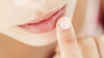 എപ്പോഴും ചുണ്ട് വരണ്ടുപൊട്ടുന്നത് ഈ അസുഖങ്ങളുടെ ലക്ഷണമാകാം...