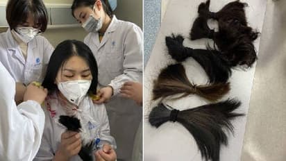 കൊറോണ വൈറസ് ബാധിതരെ ശുശ്രൂഷിക്കാന്‍ സമയം തികയുന്നില്ല, മുടിമുറിച്ച് വുഹാനിലെ നഴ്സുമാര്‍