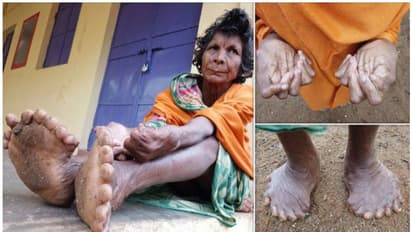 കുമാരി നായിക് ഇനി 'ദുർമന്ത്രവാദിനി'യല്ല; ഗിന്നസ് റെക്കോർഡിനുടമ!