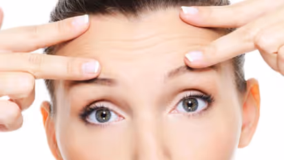 നെറ്റിയില് വരകള് വീഴുന്നത് എന്തുകൊണ്ട്? ഇത് പരിഹരിക്കാന് 5 മാര്ഗങ്ങള്...