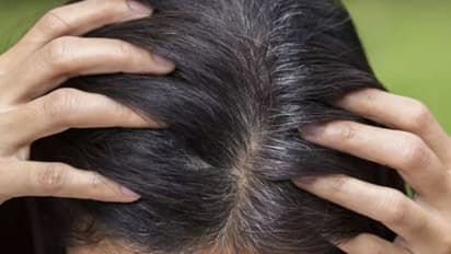 അകാലനര അകറ്റാൻ വീട്ടിലുണ്ട് പരിഹാരം