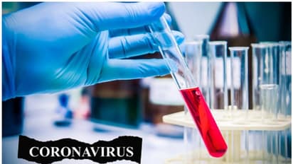 കൊറോണ: നേരിടാന് സജ്ജമായി ഇടുക്കിയും, മെഡിക്കല് ബോര്ഡ് രൂപികരിച്ചു