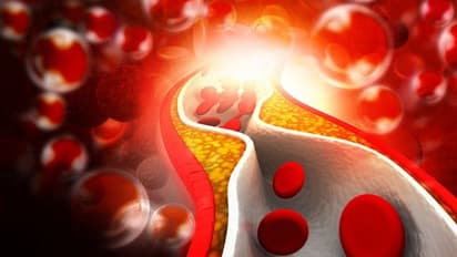 ഹൈകൊളസ്ട്രോള്; ശ്രദ്ധിക്കേണ്ട ചില പ്രധാന ലക്ഷണങ്ങള്...