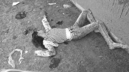 वैलेंटाइन-डे से पहले झुंझलाहट में छात्र ने अपनी क्लासमेट पहले चांटा मारा और फिर सिर में दे मारा चाकू