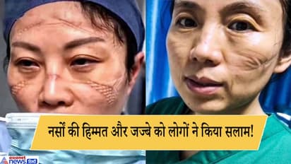 घंटो कोरोना वायरस मरीजों की खिदमत में लगीं नर्सों की हुई ऐसी हालत, हटाए मास्क तो दिखा खौफनाक हाल