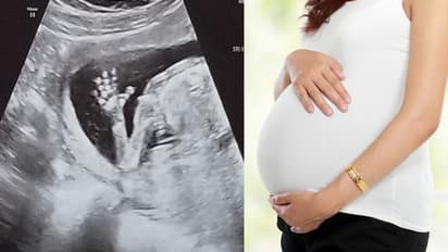 രണ്ട് യോനിയും രണ്ട് ഗര്‍ഭപാത്രവുമായി യുവതി; അപൂര്‍വ്വ അവസ്ഥ കണ്ടെത്തിയത് അള്‍ട്രാസൗണ്ട് സ്കാനിംഗില്‍