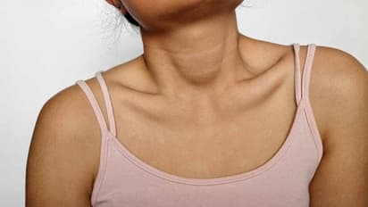 കഴുത്തിലെ കറുപ്പ് നിറം മാറ്റാന് അഞ്ച് കാര്യങ്ങള്