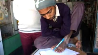 हादसे में दोनों हाथ गंवाने के बाद भी नहीं मानी हार, पैर से लिखकर दिया एग्जाम