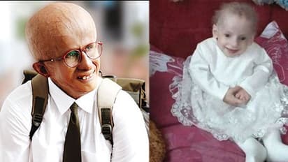 రియల్ లైఫ్‌లో ‘‘పా’’ : 8 ఏళ్లకే 80 ఏళ్ల బామ్మలా.. అరుదైన వ్యాధితో కన్నుమూసిన చిన్నారి