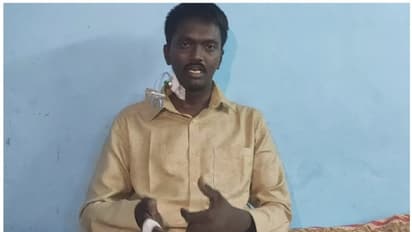 ആരോഗ്യനിലയിൽ പുരോഗതി; വാവ സുരേഷിനെ ഐസിയുവിൽ നിന്ന് മുറിയിലേക്ക് മാറ്റി