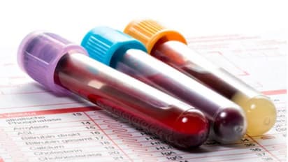 இந்தவகை ரத்தம் இருந்தால் கொரோனா வைரஸ் பரவாது..!! சீனா சொன்ன சுவாரஸ்ய தகவல்...!!