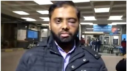 ജാമിയയിലെ പൊലീസ് ആക്രമണത്തില് കാഴ്ച നഷ്ടപ്പെട്ട വിദ്യാര്ത്ഥിക്ക് മികച്ച ഗവേഷണ പ്രബന്ധത്തിനുള്ള പുരസ്കാരം