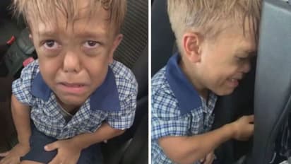 ഉയരക്കുറവിന്റെ പേരില് കളിയാക്കപ്പെട്ട ബാലന്; എന്താണ് 'ഡ്വാര്ഫിസം'