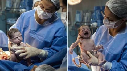 জন্মের পরেই 'রেগে আগুন' নবজাতক, নেট দুনিয়ায় ভাইরাল তাঁর ছবি