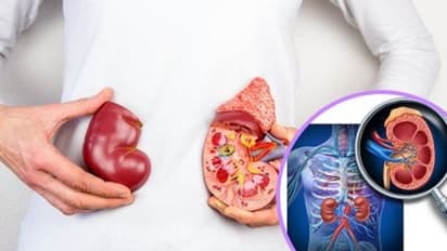 വൃക്കരോഗികൾ ഒഴിവാക്കേണ്ട പ്രധാനപ്പെട്ട അഞ്ച് ഭക്ഷണങ്ങൾ