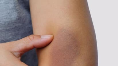 കൈമുട്ടിലെ കറുപ്പ് നിറം മാറ്റാന് ചെയ്യേണ്ടത്...