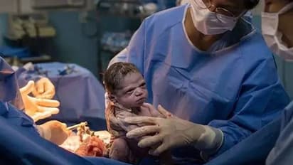 അമ്മയുടെ വയറ്റിൽ നിന്ന് എന്തിനാ എന്നെ പുറത്തെടുത്തേ; വൈറലായി ചിത്രം