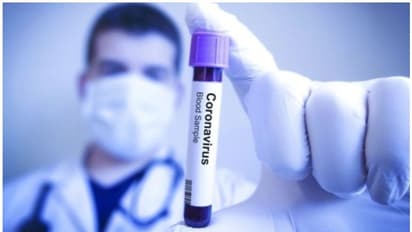 ಕೊರೋನಾ ತಗುಲಿಸಿಕೊಂಡರೆ, ಈ ಕಂಪನಿ ಕೊಡುತ್ತೆ ದೊಡ್ಡ ಮೊತ್ತ!