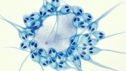 অক্সিজেন ছাড়াই বাঁচে এই প্রাণীরা, নতুন খোঁজ বিজ্ঞানীদের