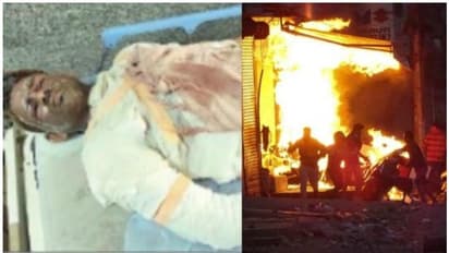 അയല്ക്കാരായ മുസ്ലീങ്ങളെ രക്ഷിച്ചു; പൊള്ളലേറ്റ പ്രേംകാന്ത് ജീവനുമായി മല്ലിടുന്നു