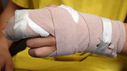 കുട്ടികള് തമ്മിലുള്ള കയ്യാങ്കളി വീട്ടുകാരിലേക്കും, യുവതിയുടെ കൈ കടിച്ചുമുറിച്ചു, പ്രതി ഒളിവില്