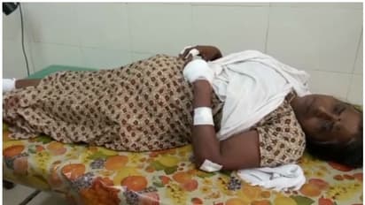 കണ്ണൂരിൽ തൊഴിലുറപ്പ് ജോലിയ്ക്കിടെ ബോംബ് സ്ഫോടനം; ഒരു സ്ത്രീയ്ക്ക് പരിക്ക്