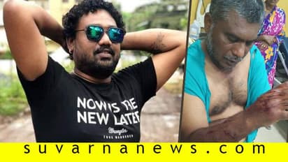 ಪತ್ನಿಯ ಜೊತೆ ಅಕ್ರಮ ಸಂಬಂಧ: ಪ್ರಶ್ನಿಸಿದ ಗಂಡನ ಮೇಲೆ ನಾಯಿ ಛೂ ಬಿಟ್ಟ ಪ್ರಿಯಕರ!