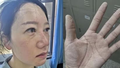 தூக்கமில்லா கண்கள்... மாஸ்க்கினால் உருவான வடுக்கள்...கொரோனா அரக்கனுக்கு எதிராக களம் புகுந்த சிங்கப்பெண்கள்...!