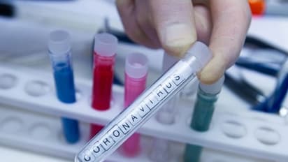 கொரோனாவை ஒழிக்க அமெரிக்கா கண்டிபிடித்த தடுப்பூசி..!! 45 பேருக்கு முதற்கட்ட பரிசோதனை தொடங்கியது..!!