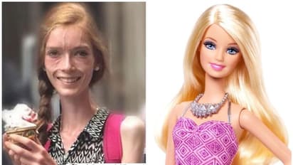 ബാര്ബിയുടേതുപോലുള്ള ശരീരം കിട്ടാന് പട്ടിണി കിടന്ന മനുഷ്യര്; ബാര്ബിക്കിന്ന് 61 വയസ്സ്