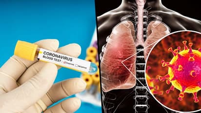 ఇదేం ఆఫర్... కరోనా వైరస్ ఎక్కించుకుంటే రూ.3లక్షలా..!