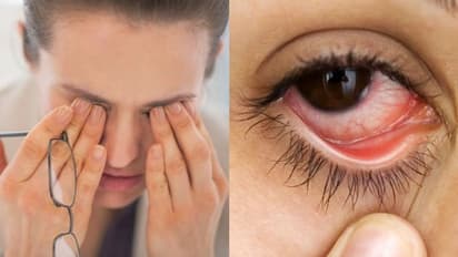 എന്താണ് പിങ്ക് ഐ രോഗം ? ലക്ഷണങ്ങളറിയാം