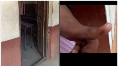 എസ്എസ്എല്സി പരീക്ഷ നടക്കുന്നതിനിടെ വിദ്യാർത്ഥിക്ക് തെരുവുനായയുടെ കടിയേറ്റു