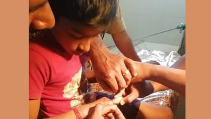 ഒൻപത് വയസ്സുകാരന്റെ കൈവിരലിൽ കുടുങ്ങിയ സ്റ്റീൽ നട്ട് ഊരിയെടുത്ത് അഗ്നിരക്ഷാസേന