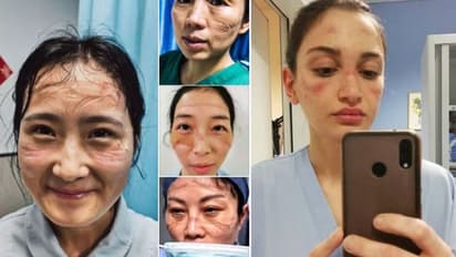 വിശപ്പും ദാഹവും വേദനയും മറന്ന് സേവനം; ലോകം നിങ്ങളെ മറക്കില്ല...